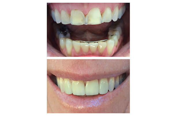 Before and After Image 1