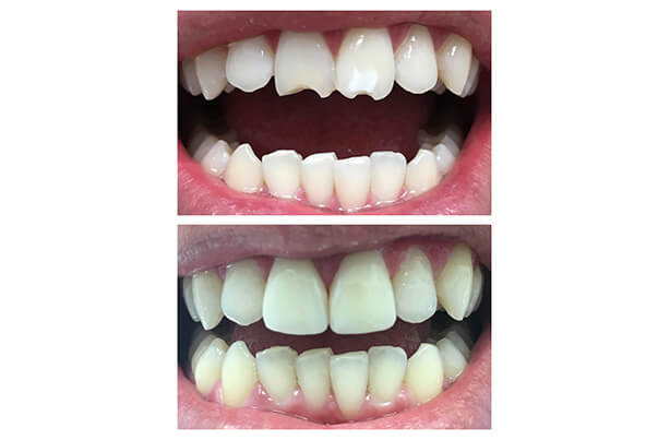 Before and After Image 2