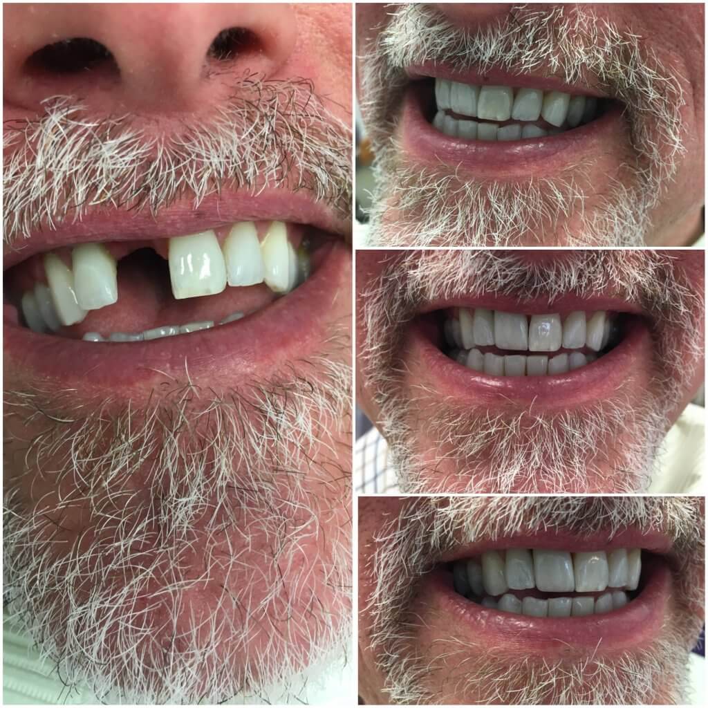 Before and After Image 5