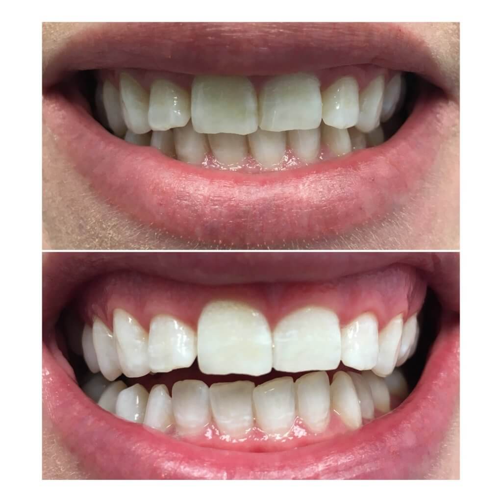 Before and After Image 6