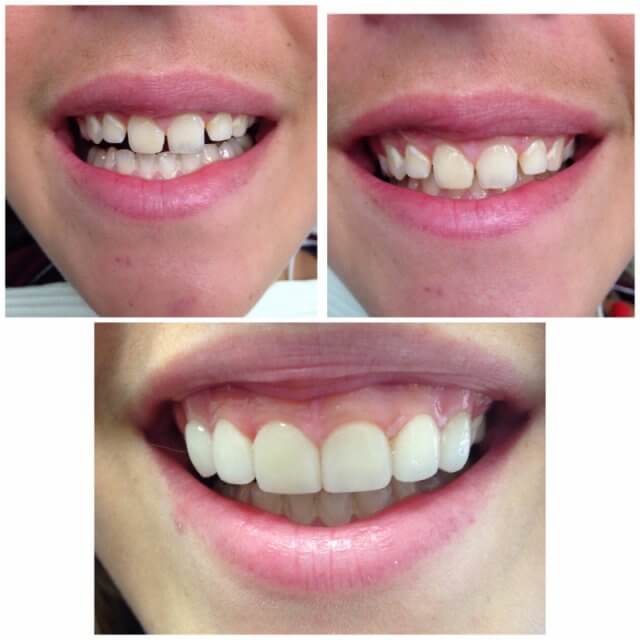 Before and After Image 8