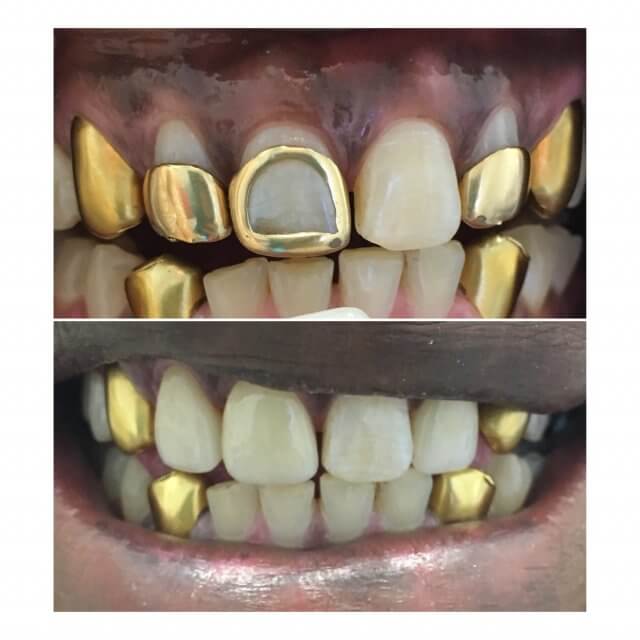 Before and After Image 9